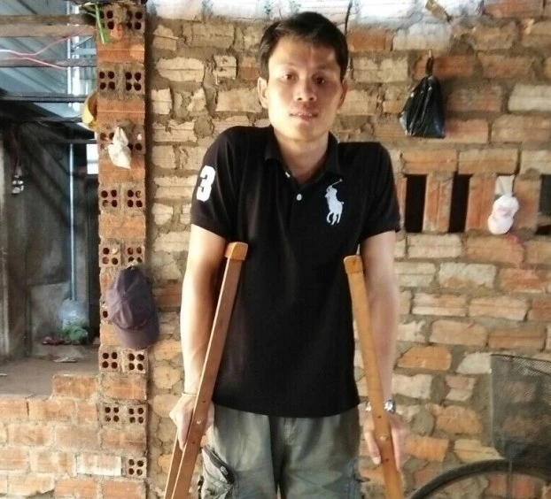 Mất khả năng lao động sau tai nạn giao thông